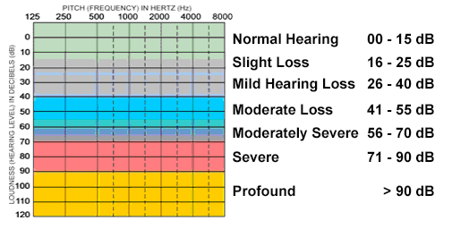 تقسیم‌بندی میزان کم شنوایی به درجات مختلف از حالت کاملا سالم تا حالت ناشنوایی کامل.