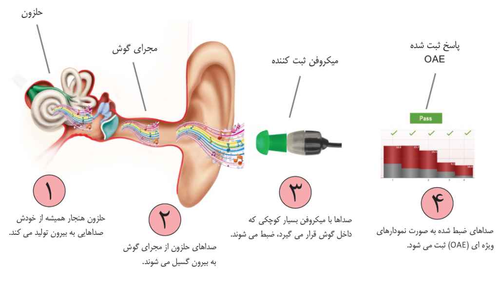 مراحل ثبت گسیل‌های صوتی گوش به وسیله‌ی میکروفن ظریف کوچکی که درون گوش گذاشته می‌شود و انعکاسات برگشتی از سوی حلزون و سلول‌های مویی خارجی ثبت می‌شود.