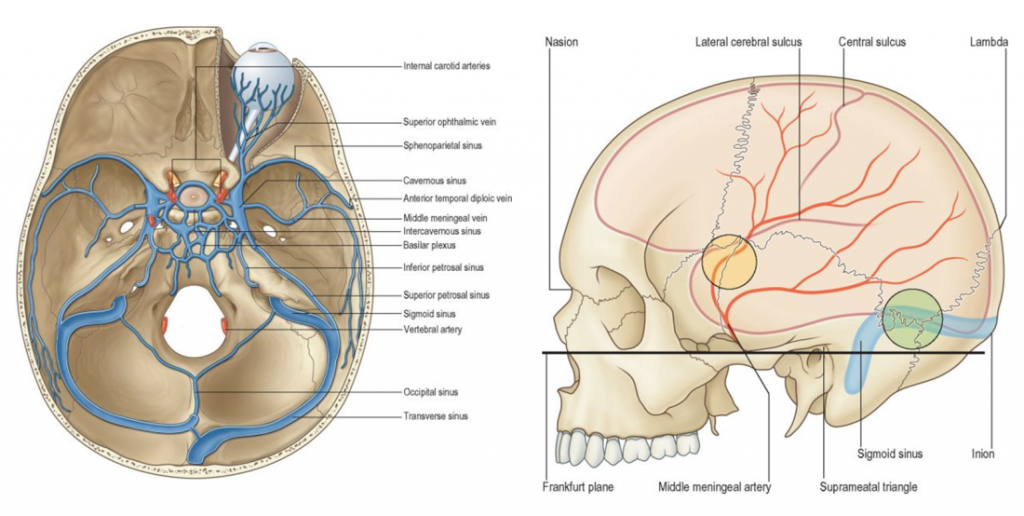 در نزدیکی گوش،  یکی از عروقی مهم مغز به نام سینوس سیگمویید قرار دارد (قسمتی که با دایره‌ی سبز در سمت راست تصویر نشان داده شده است) 